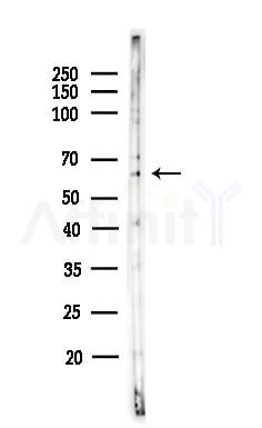 UGT1A6 Antibody - Western blot analysis of lysates from HepG2 cells(heat-shock,45min treatment), using UGT1A6 Antibody at 1/1000 dilution.