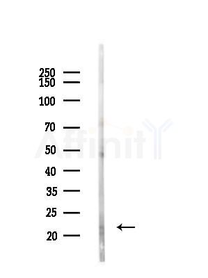 BASP1 Antibody - Western blot analysis of lysates from COLO205 cells(UV,30min treatment), using BASP1 Antibody at 1/1000 dilution.
