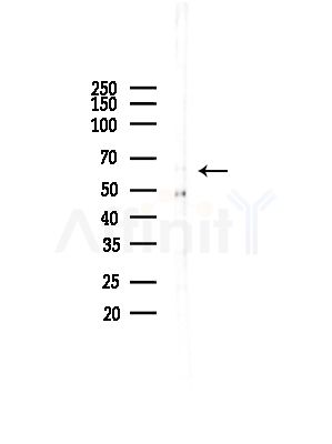 SSX2IP Antibody - Western blot analysis of lysates from COLO205 cells(UV,30min treatment), using SSX2IP Antibody at 1/1000 dilution.