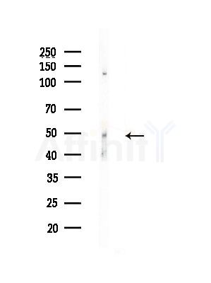 beta II Tubulin Antibody - Western blot analysis of lysates from A375 cells(LPS, 4h treatment), using beta II Tubulin Antibody at 1/1000 dilution.