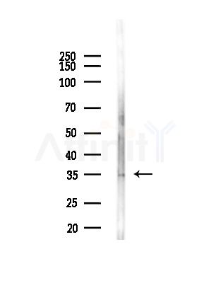 KIR2DL4 Antibody - Western blot analysis of lysates from COLO205 cells(heat-shock,45min treatment), using KIR2DL4 Antibody at 1/1000 dilution.