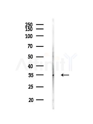 KIR2DL4 Antibody - Western blot analysis of lysates from Hela cells(starvation,24h treatment), using KIR2DL4 Antibody at 1/1000 dilution.