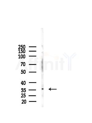 KLF2 Antibody - Western blot analysis of lysates from A375 cells(starvation,24h treatment), using KLF2 Antibody at 1/1000 dilution.