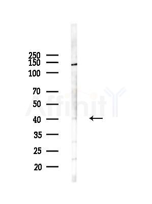 KC1AL Antibody - Western blot analysis of lysates from LoVo cells(heat-shock,45min treatment), using KC1AL Antibody at 1/1000 dilution.