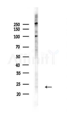 Amino-terminal enhancer of split Antibody - Western blot analysis of lysates from COLO205 cells(UV,30min treatment), using Amino-terminal enhancer of split Antibody at 1/1000 dilution.