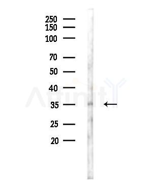 XAF1 Antibody - Western blot analysis of lysates from MDA-MB-231 cells, using XAF1 Antibody at 1/1000 dilution.