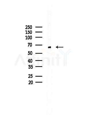 Dcp2 Antibody - Western blot analysis of lysates from Mouse testis, using Dcp2 Antibody at 1/1000 dilution.