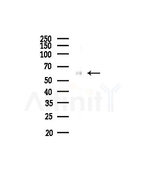 Gliomedin Antibody - Western blot analysis of lysates from Rat liver, using Gliomedin Antibody at 1/1000 dilution.