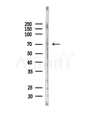 Hhip Antibody - Western blot analysis of lysates from Hela cells(heat-shock,45min treatment), using Hhip Antibody at 1/1000 dilution.
