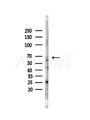 Hhip Antibody - Western blot analysis of lysates from Rat brain, using Hhip Antibody at 1/1000 dilution.