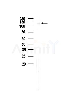 SAP155 Antibody - Western blot analysis of lysates from Rat liver, using SAP155 Antibody at 1/1000 dilution.