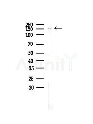 SAP155 Antibody - Western blot analysis of lysates from COLO205 cells(UV,30min treatment), using SAP155 Antibody at 1/1000 dilution.