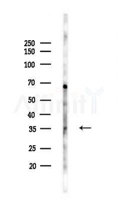 TIM 4 Antibody - Western blot analysis of lysates from COLO205 cells(UV,30min treatment), using TIM 4 Antibody at 1/1000 dilution.