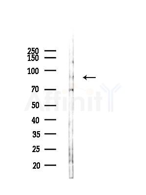 L3MBTL1 Antibody - Western blot analysis of lysates from COLO205 cells(UV,30min treatment), using L3MBTL1 Antibody at 1/1000 dilution.
