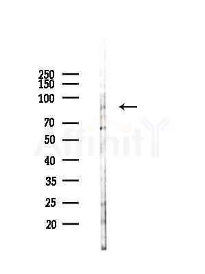 L3MBTL1 Antibody - Western blot analysis of lysates from LoVo cells(heat-shock,45min treatment), using L3MBTL1 Antibody at 1/1000 dilution.