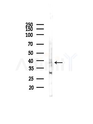 Asporin Antibody - Western blot analysis of lysates from COLO205 cells(UV,30min treatment), using Asporin Antibody at 1/1000 dilution.