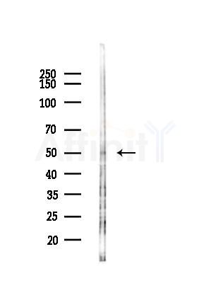 SLC16A8 Antibody - Western blot analysis of lysates from LoVo cells(heat-shock,45min treatment), using SLC16A8 Antibody at 1/1000 dilution.