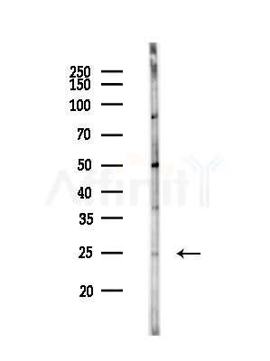 MIS12 Antibody - Western blot analysis of lysates from Hela cells(starvation,24h treatment), using MIS12 Antibody at 1/1000 dilution.