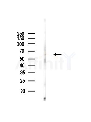 GLUT12 Antibody - Western blot analysis of lysates from Rat brain, using GLUT12 Antibody at 1/1000 dilution.