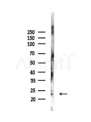 Apolipoprotein M Antibody - Western blot analysis of lysates from PC12 cells(LPS, 4h treatment), using Apolipoprotein M Antibody at 1/1000 dilution.