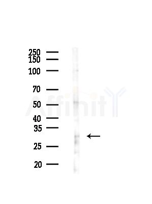 Dynorphin A Antibody - Western blot analysis of lysates from HepG2 cells(LPS, 4h treatment), using Dynorphin A Antibody at 1/1000 dilution.