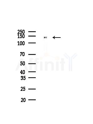 MAML2 Antibody - Western blot analysis of lysates from HepG2 cells(LPS, 4h treatment), using MAML2 Antibody at 1/1000 dilution.