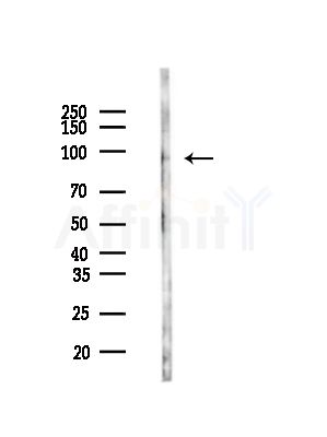 VLDL Receptor Antibody - Western blot analysis of lysates from HepG2 cells(LPS, 4h treatment), using VLDL Receptor Antibody at 1/1000 dilution.