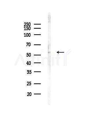 PPP2R5C Antibody - Western blot analysis of lysates from Mouse brain, using PPP2R5C Antibody at 1/1000 dilution.