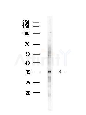 DLST Antibody - Western blot analysis of lysates from RAW264.