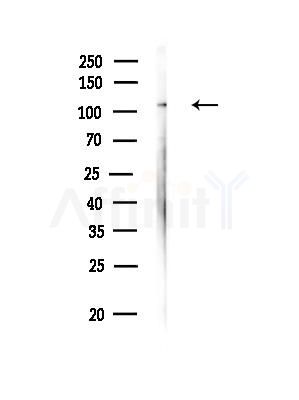 Importin 7 Antibody - Western blot analysis of lysates from MDA-MB-231 cells(heat-shock, 45min treatment), using Importin 7 Antibody at 1/1000 dilution.