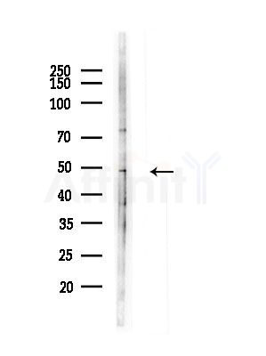 VPS36 Antibody - Western blot analysis of lysates from A375 cells(LPS, 4h treatment), using VPS36 Antibody at 1/1000 dilution.