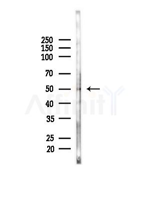 AADACL1 Antibody - Western blot analysis of lysates from Hela cells(heat-shock,45min treatment), using AADACL1 Antibody at 1/1000 dilution.