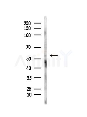 AADACL1 Antibody - Western blot analysis of lysates from Mouse testis, using AADACL1 Antibody at 1/1000 dilution.