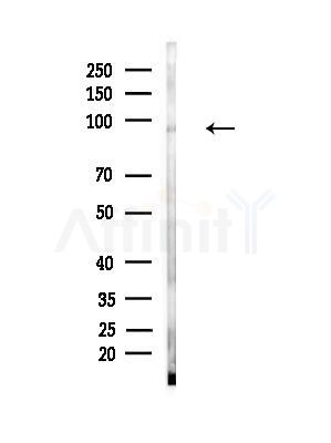 Zfp281 Antibody - Western blot analysis of lysates from Mouse muscle, using Zfp281 Antibody at 1/1000 dilution.