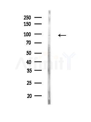 Zfp281 Antibody - Western blot analysis of lysates from MDA-MB-231 cells(heat-shock, 45min treatment), using Zfp281 Antibody at 1/1000 dilution.