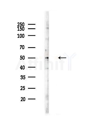 TCP1 beta Antibody - Western blot analysis of lysates from RAW264.