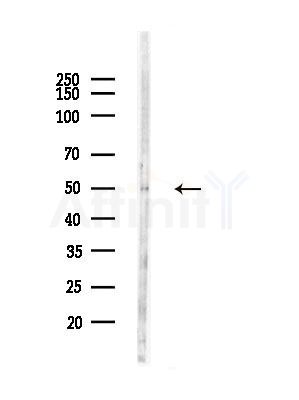 Hyaluronan synthase 2 Antibody - Western blot analysis of lysates from RAW264.