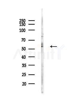Hyaluronan synthase 2 Antibody - Western blot analysis of lysates from A375 cells(LPS, 4h treatment), using Hyaluronan synthase 2 Antibody at 1/1000 dilution.