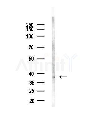 p40 Antibody - Western blot analysis of lysates from COLO205 cells(heat-shock,45min treatment), using p40 Antibody at 1/1000 dilution.