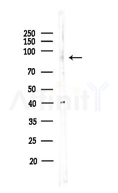 Pyrin Antibody - Western blot analysis of lysates from HepG2 cells(heat-shock,45min treatment), using Pyrin Antibody at 1/1000 dilution.