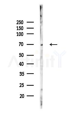 Sts1 Antibody - Western blot analysis of lysates from MCF7 cells(heat-shock,45min treatment), using Sts1 Antibody at 1/1000 dilution.