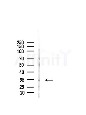 CCDC28A Antibody - Western blot analysis of lysates from A375 cells(starvation,24h treatment), using CCDC28A Antibody at 1/1000 dilution.