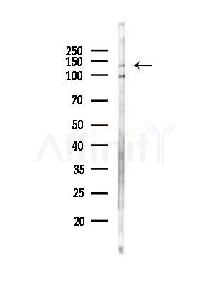 SCAP Antibody - Western blot analysis of lysates from PC12 cells(heat-shock,45min treatment), using SCAP Antibody at 1/1000 dilution.