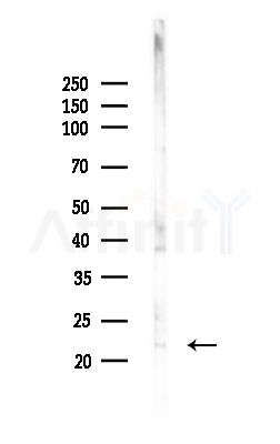 AMELX Antibody - Western blot analysis of lysates from MCF7 cells(heat-shock,45min treatment), using AMELX Antibody at 1/1000 dilution.