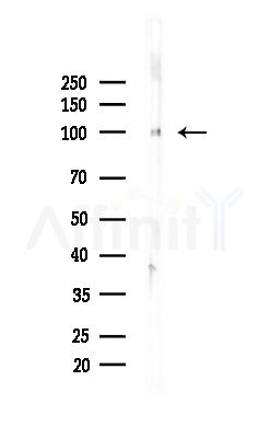 TAP1 Antibody - Western blot analysis of lysates from Mouse brain, using TAP1 Antibody at 1/1000 dilution.