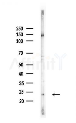 Placental lactogen Antibody - Western blot analysis of lysates from A375 cells(heat-shock,45min treatment), using Placental lactogen Antibody at 1/1000 dilution.