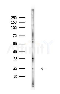 Placental lactogen Antibody - Western blot analysis of lysates from MCF7 cells(heat-shock,45min treatment), using Placental lactogen Antibody at 1/1000 dilution.