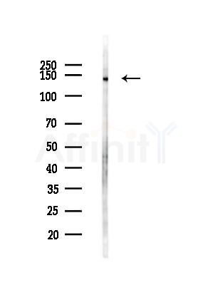 SMC5 Antibody - Western blot analysis of lysates from COLO205 cells(UV,30min treatment), using SMC5 Antibody at 1/1000 dilution.