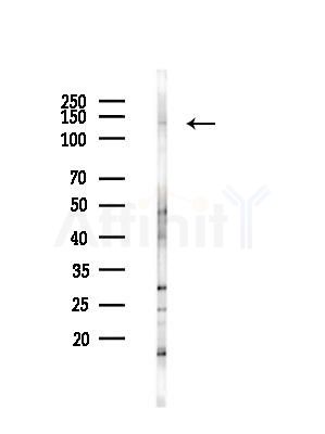 SMC5 Antibody - Western blot analysis of lysates from LoVo cells(heat-shock,45min treatment), using SMC5 Antibody at 1/1000 dilution.