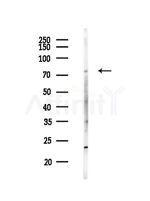 IL4I1 Antibody - Western blot analysis of lysates from Hela cells(starvation,24h treatment), using IL4I1 Antibody at 1/1000 dilution.